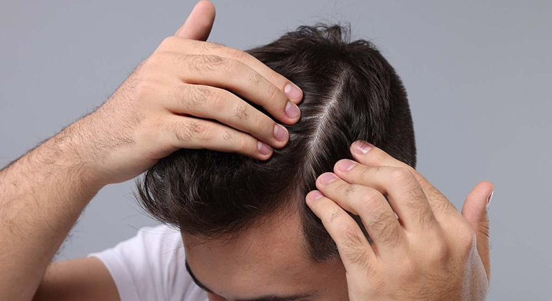 En este momento estás viendo En Otoño se incrementa la caída del cabello, aquí la respuesta del Dr. Enrique Orozco